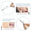 BEAUTY MOLE REMOVAL SWEEP SPOT PEN
