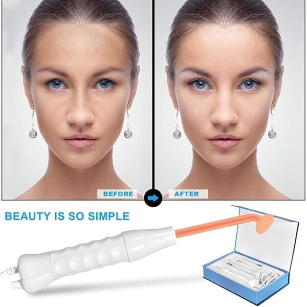 High Frequency Facial Machine for Acne
